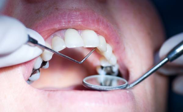 Looking for Dental Patients for Student Dentist Regional Boards (South Jordan)